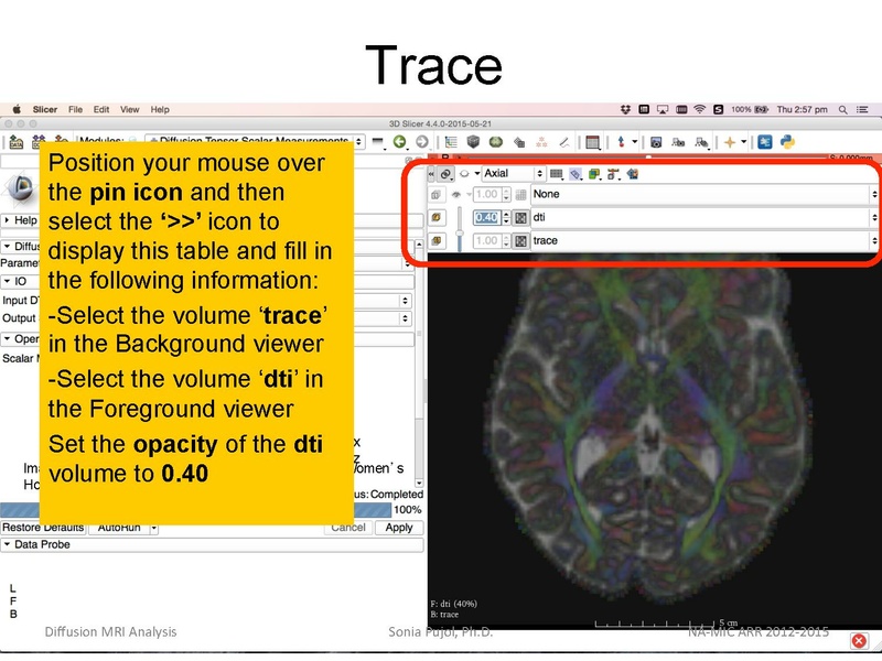 File:DiffusionMRIanalysis Tutorial Slicer4.5 SoniaPujol.pdf