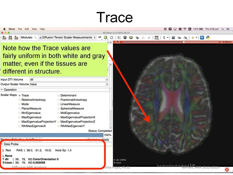 File:DiffusionMRIanalysis Tutorial Slicer4.5 SoniaPujol.pdf