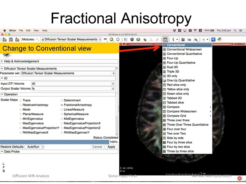 File:DiffusionMRIanalysis Tutorial Slicer4.5 SoniaPujol.pdf