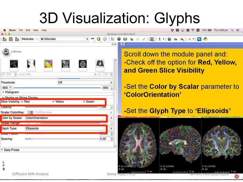 File:DiffusionMRIanalysis Tutorial Slicer4.5 SoniaPujol.pdf