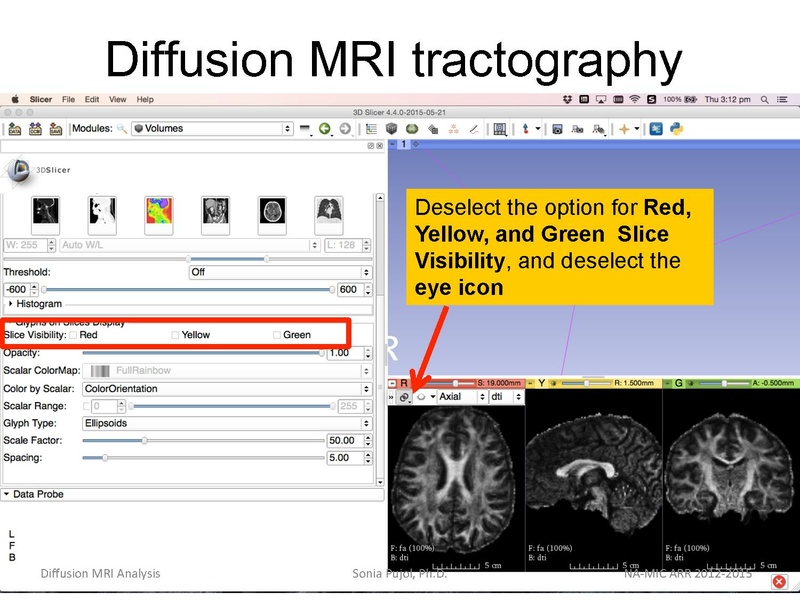 File:DiffusionMRIanalysis Tutorial Slicer4.5 SoniaPujol.pdf