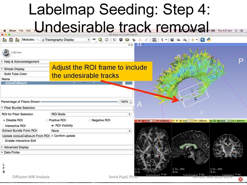 File:DiffusionMRIanalysis Tutorial Slicer4.5 SoniaPujol.pdf