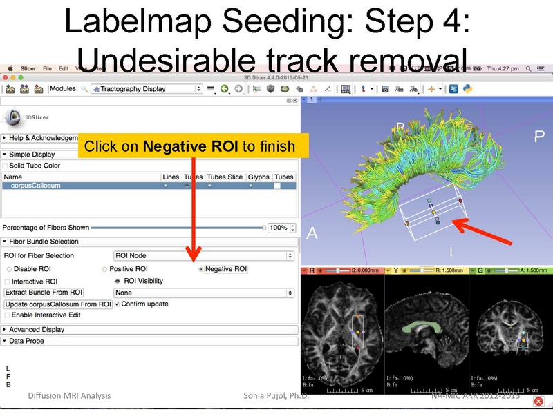 File:DiffusionMRIanalysis Tutorial Slicer4.5 SoniaPujol.pdf