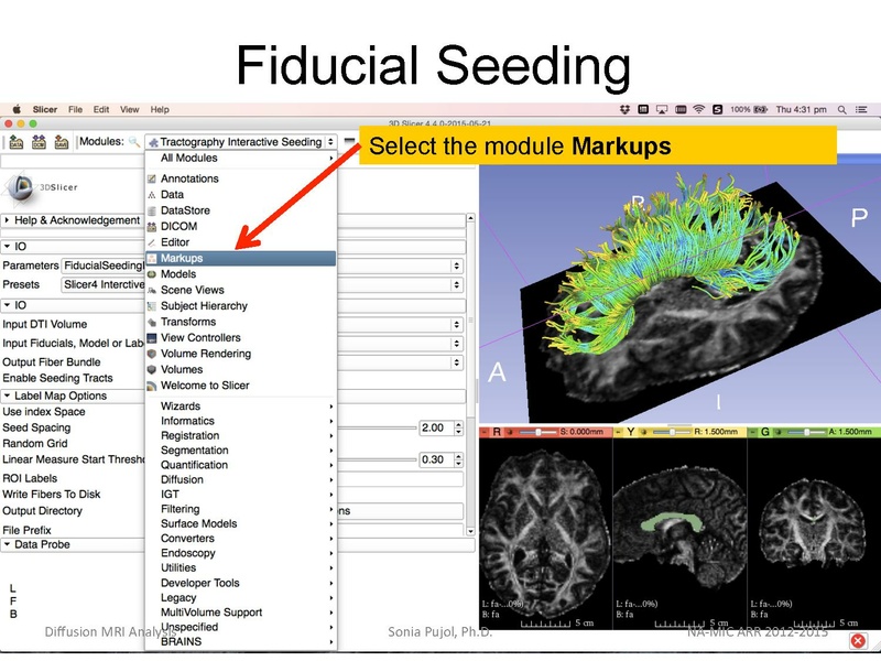 File:DiffusionMRIanalysis Tutorial Slicer4.5 SoniaPujol.pdf