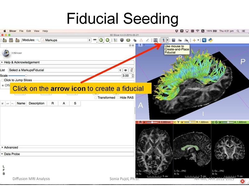 File:DiffusionMRIanalysis Tutorial Slicer4.5 SoniaPujol.pdf