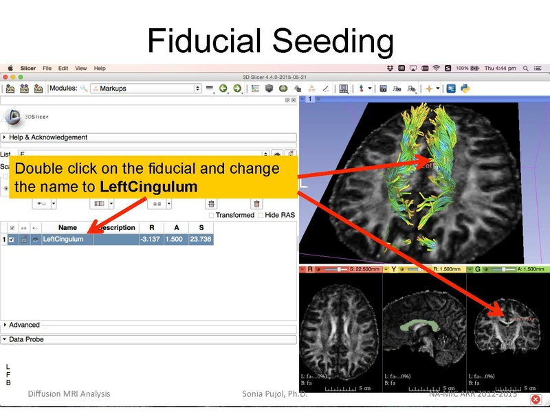 File:DiffusionMRIanalysis Tutorial Slicer4.5 SoniaPujol.pdf