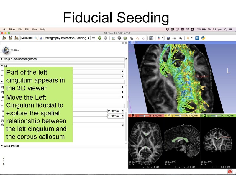 File:DiffusionMRIanalysis Tutorial Slicer4.5 SoniaPujol.pdf