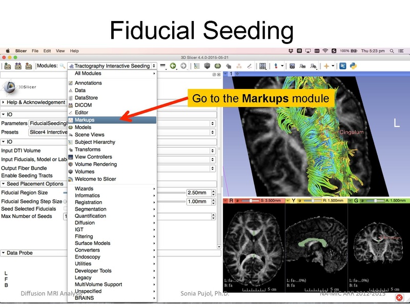 File:DiffusionMRIanalysis Tutorial Slicer4.5 SoniaPujol.pdf