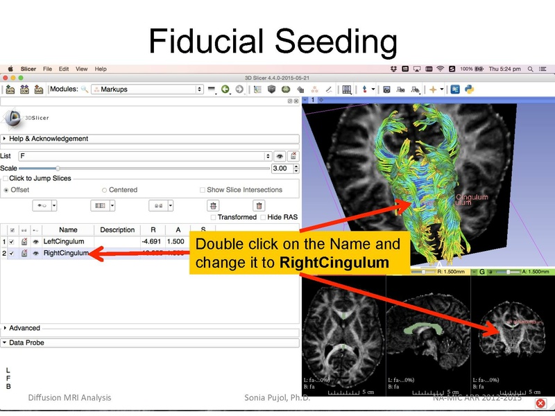 File:DiffusionMRIanalysis Tutorial Slicer4.5 SoniaPujol.pdf