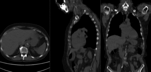 RegLib C20 unregistered.gif