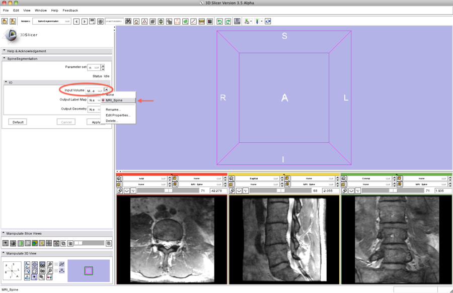 Modules:SpineSegmentation-Documentation-3.6 - Slicer Wiki