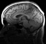 this is the T1 moving image