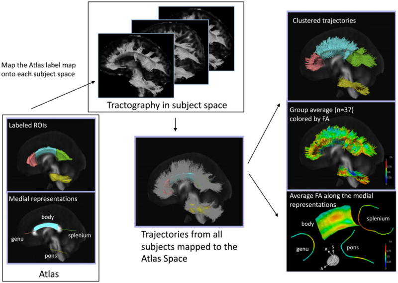 File:Schulte-Neuroimage2013-fig1.png