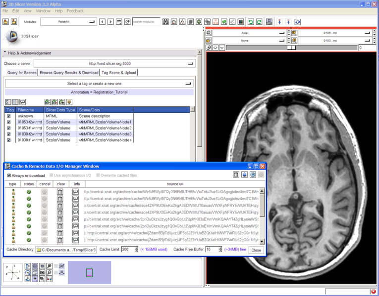 File:FetchMIDoc SlicerRegistration.png