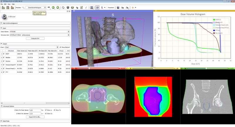File:SlicerRT-0.2 screenshot.png