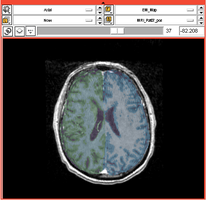 EMSegment PETCT Physiology-2.png