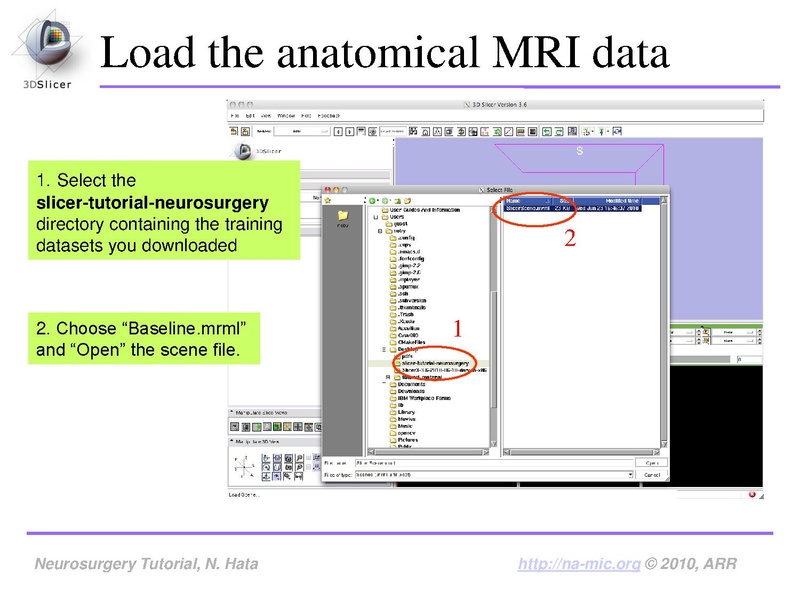 File:SlicerNeurosurgeryTutorial-3.6.1.pdf
