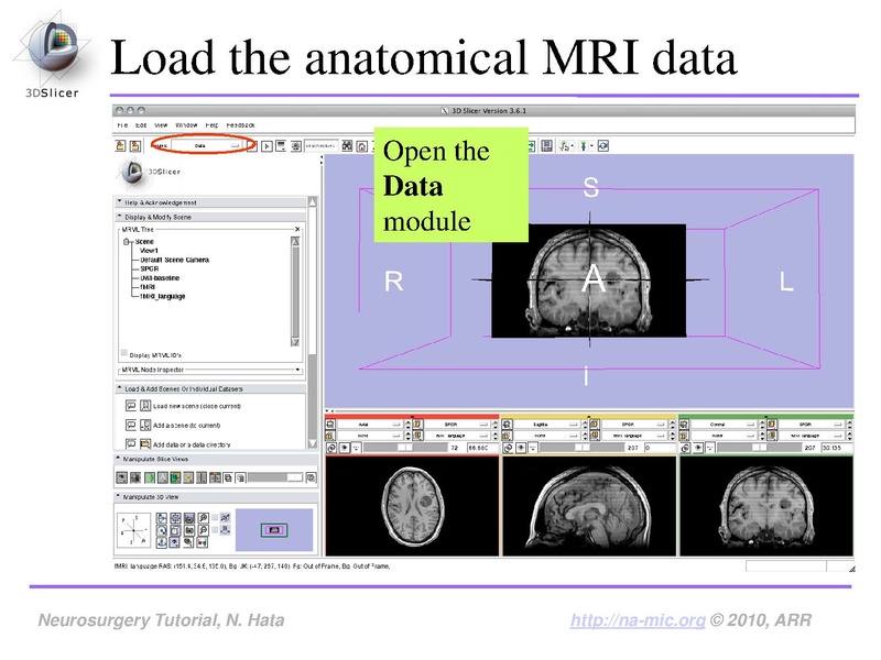 File:SlicerNeurosurgeryTutorial-3.6.1.pdf