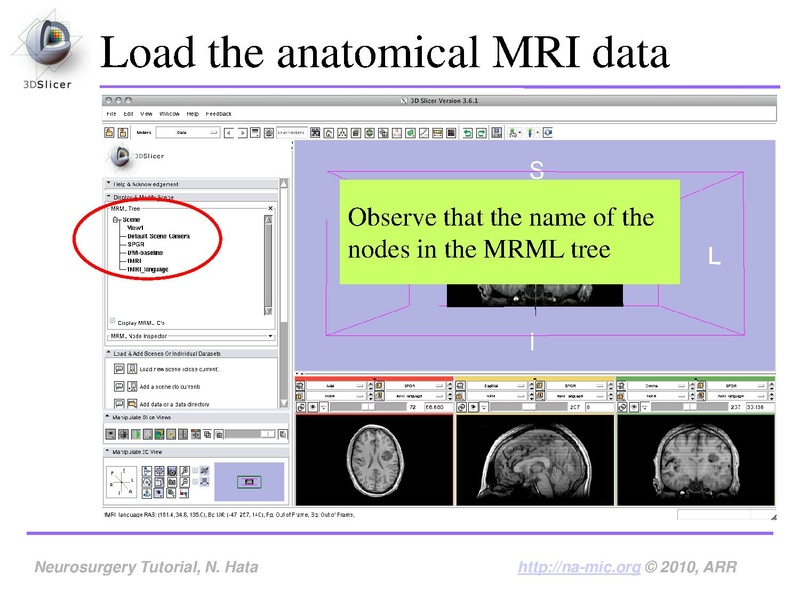 File:SlicerNeurosurgeryTutorial-3.6.1.pdf