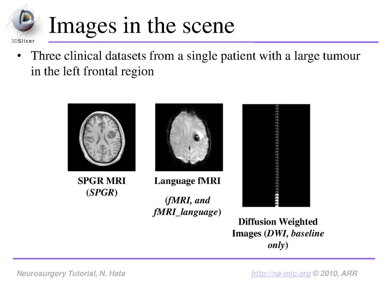 File:SlicerNeurosurgeryTutorial-3.6.1.pdf