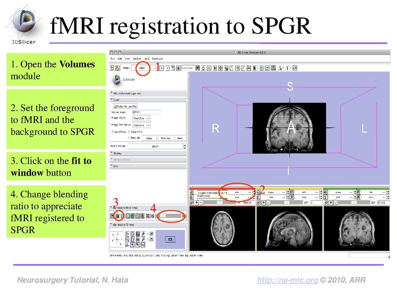 File:SlicerNeurosurgeryTutorial-3.6.1.pdf