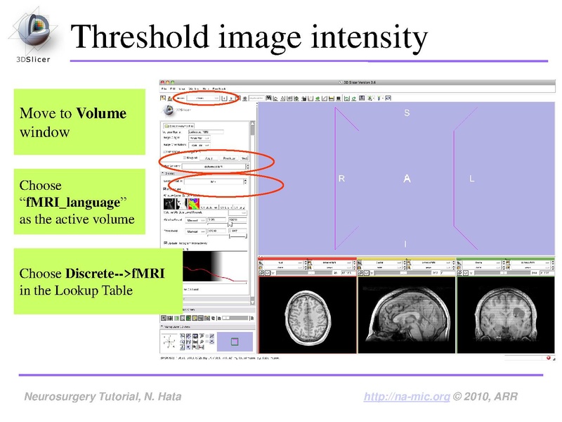 File:SlicerNeurosurgeryTutorial-3.6.1.pdf