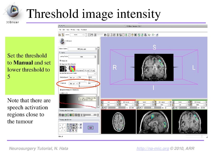 File:SlicerNeurosurgeryTutorial-3.6.1.pdf