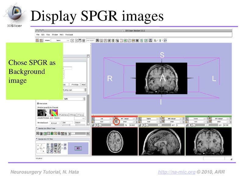 File:SlicerNeurosurgeryTutorial-3.6.1.pdf