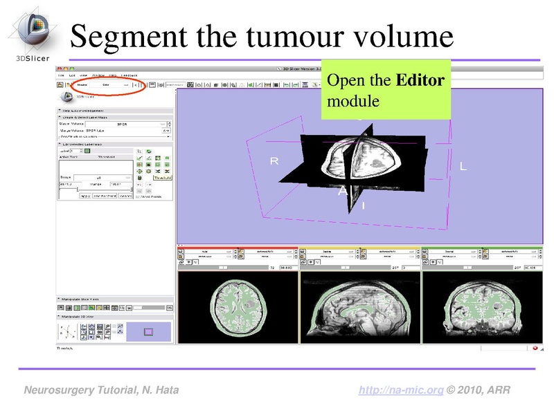 File:SlicerNeurosurgeryTutorial-3.6.1.pdf