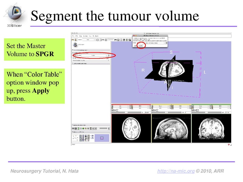 File:SlicerNeurosurgeryTutorial-3.6.1.pdf