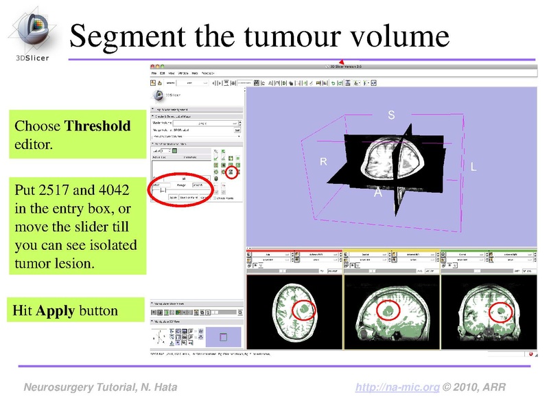 File:SlicerNeurosurgeryTutorial-3.6.1.pdf