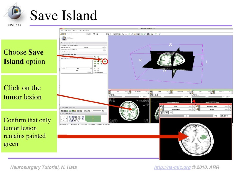 File:SlicerNeurosurgeryTutorial-3.6.1.pdf