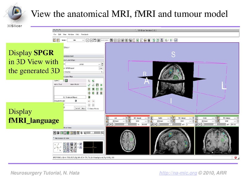 File:SlicerNeurosurgeryTutorial-3.6.1.pdf