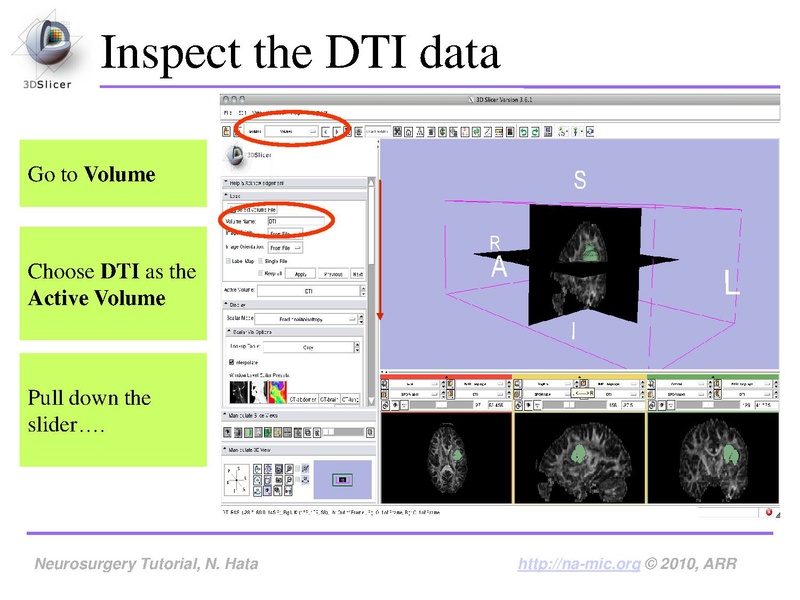 File:SlicerNeurosurgeryTutorial-3.6.1.pdf