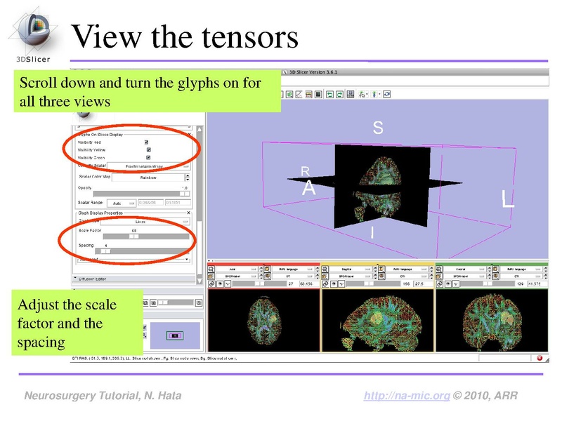 File:SlicerNeurosurgeryTutorial-3.6.1.pdf