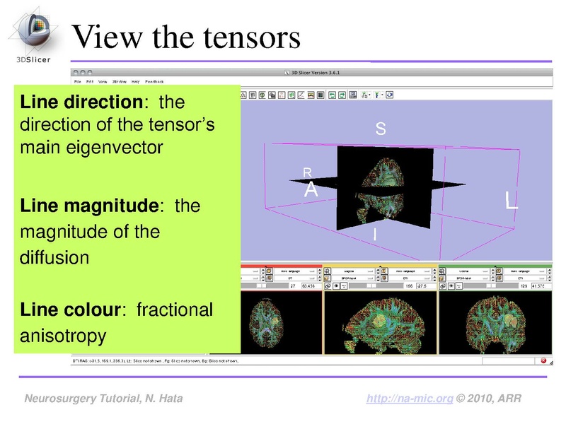File:SlicerNeurosurgeryTutorial-3.6.1.pdf