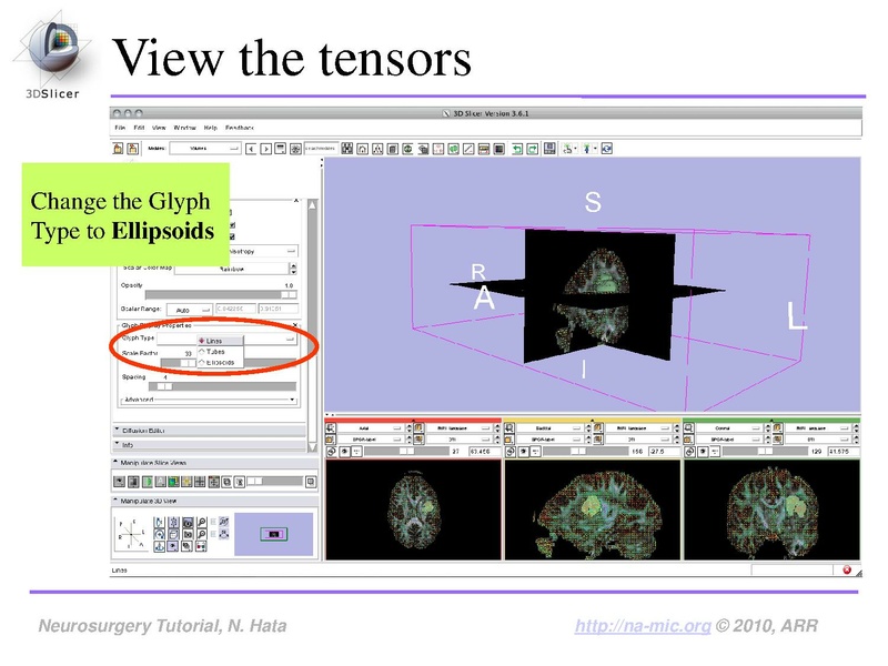 File:SlicerNeurosurgeryTutorial-3.6.1.pdf