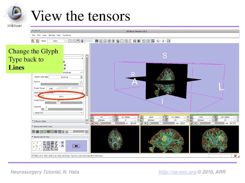 File:SlicerNeurosurgeryTutorial-3.6.1.pdf