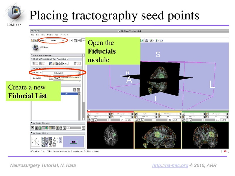 File:SlicerNeurosurgeryTutorial-3.6.1.pdf