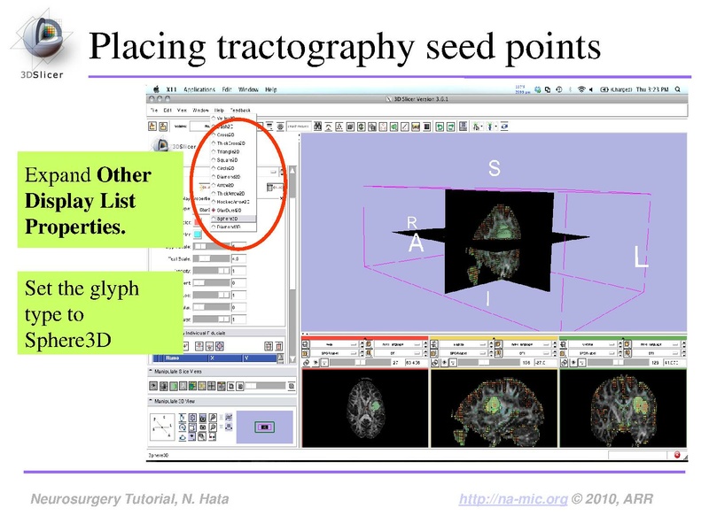File:SlicerNeurosurgeryTutorial-3.6.1.pdf