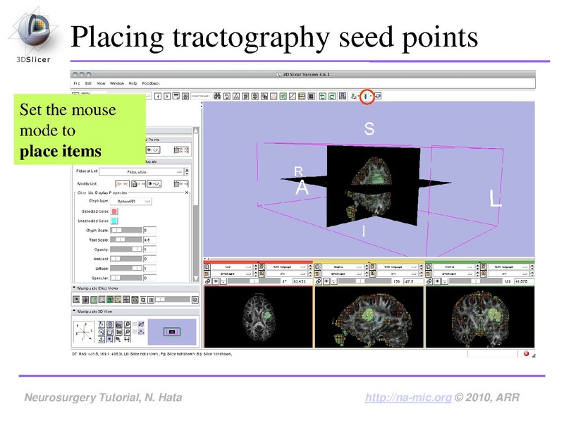 File:SlicerNeurosurgeryTutorial-3.6.1.pdf