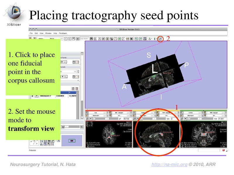 File:SlicerNeurosurgeryTutorial-3.6.1.pdf
