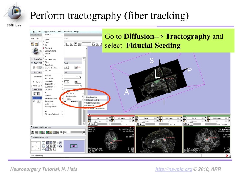 File:SlicerNeurosurgeryTutorial-3.6.1.pdf