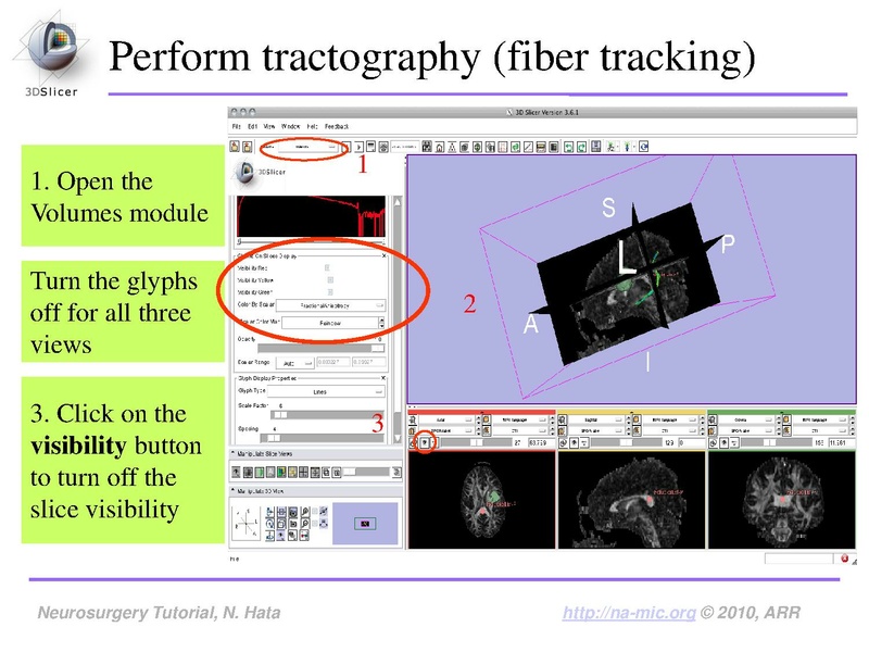 File:SlicerNeurosurgeryTutorial-3.6.1.pdf