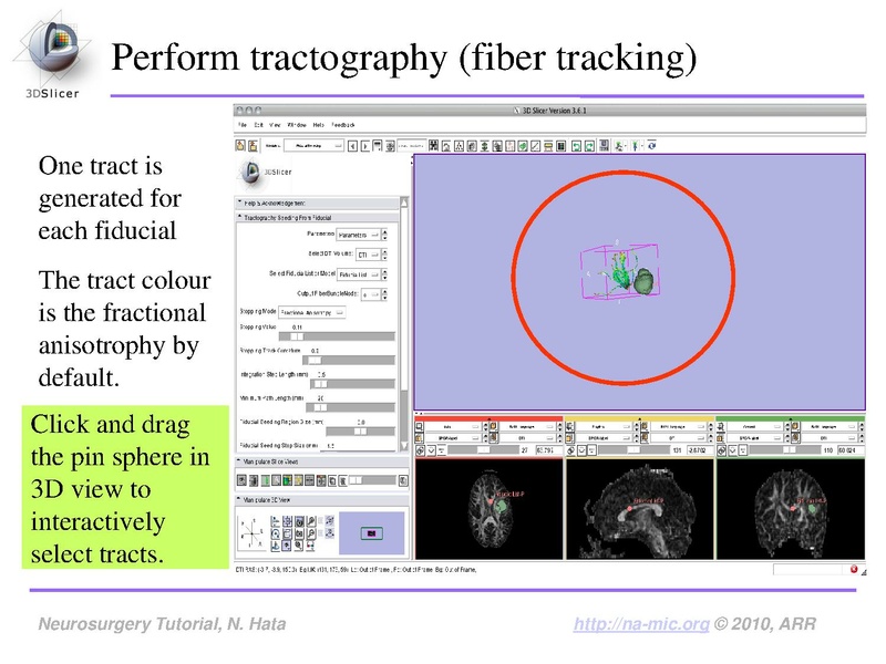 File:SlicerNeurosurgeryTutorial-3.6.1.pdf
