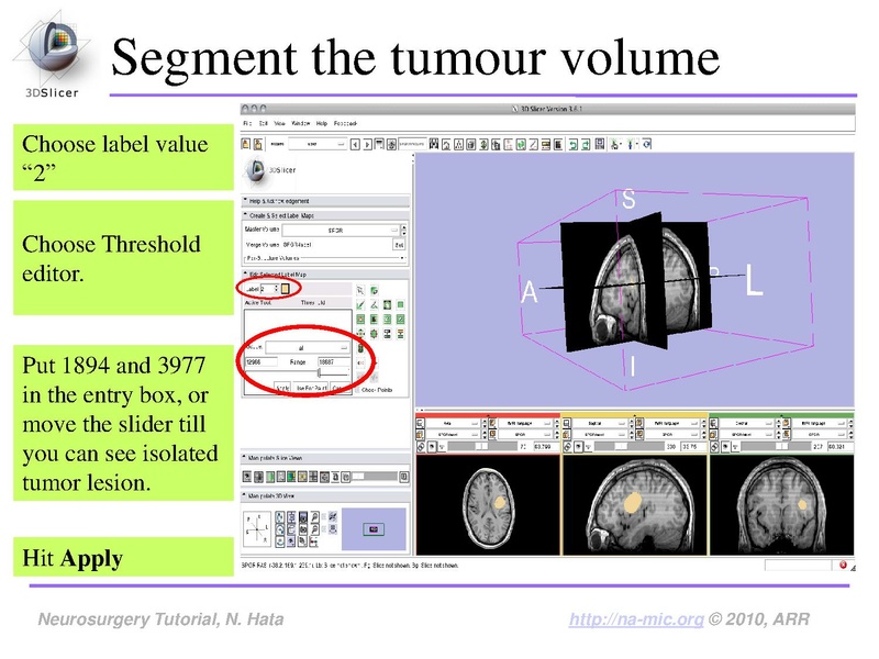 File:SlicerNeurosurgeryTutorial-3.6.1.pdf