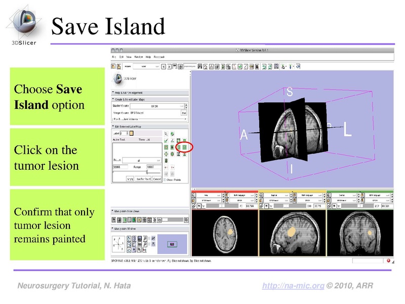 File:SlicerNeurosurgeryTutorial-3.6.1.pdf