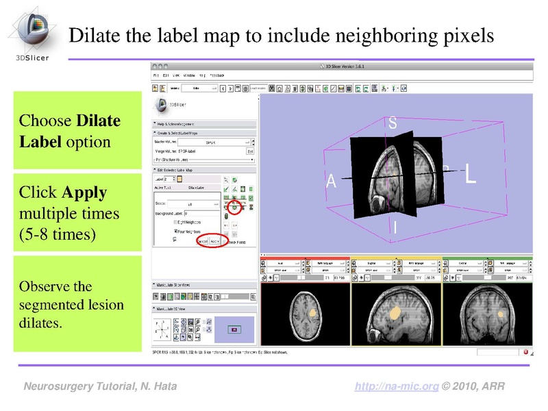 File:SlicerNeurosurgeryTutorial-3.6.1.pdf