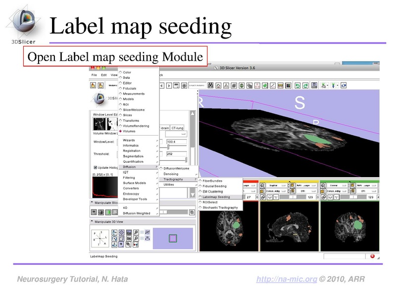 File:SlicerNeurosurgeryTutorial-3.6.1.pdf