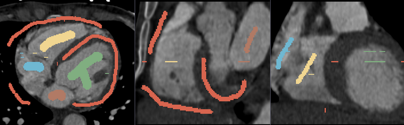 File:FGC Heart Seed.png